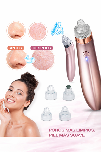 Limpiador Facial Succionador Y Removedor Puntos Negros